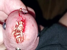 Maggots Packing Bloody Hole