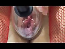 French Girl Uses Vaginal Pump