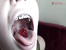 Blue- Eyed Golden-Haired With Braces Is Licking And Eating Gummy Bears In A Very Hot Way