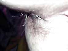 Hairy Asshole Mature Woman Poop's Closeup