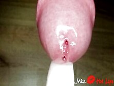 Close Up Amateur Female Domination Wrecked Orgasm With Urethral Sounding.  Frenulum Stimulation
