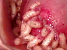 Maggot In Pee Hole