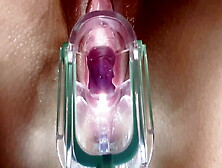 Stella St.  Rose - Extreme Gaping,  See My Cervix Close-Up Using A Speculum