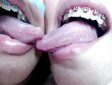 Deep Tounge Kissing Between Two Brace Lesbian