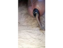 A Worm Enter In My Cock