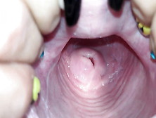 Cervix Close Up