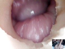 Andrada Endoscope Twat Fuck - 10/10