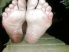 Mature Lady 0Ff The Streets Shows 0Ff Her Dirty Feet - Really Bad