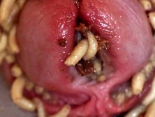 Maggots In Foreskin And Peehole Pt2