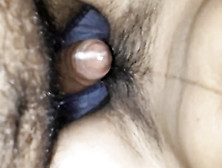 Closeup Shots Of Hairy Indian Teen Pussy Fucked