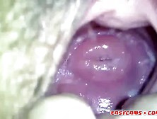 My Japanese Girlfend's Cute Cervix In Huge Hole