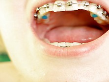 Eating In Braces - Vore And Food Fetish - Close Up Video
