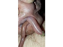 A Worm Disappears Inside My Cock