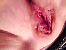 Shaved Virgin Pooping A Big One In Close Up