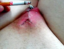 Cbt Slave.  Burning With Cigarettes.  Human Ashtray.  Locked In A Tiny Chastity With Superglue