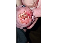 Bloody Maggot Hole