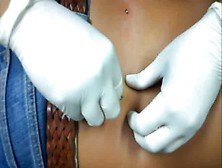 Lower Back Dimple Dermals By Tom Hasch. Mp4