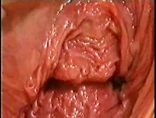 Monster Vagina.  Extreme Piercing.  Fisting