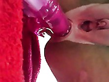 Wife's Big Clit And Unique Pussy Gaping Asshole