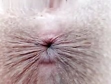 Extreme Asshole Closeup
