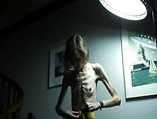 Anorexic Sonja 8