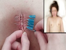 Bf Piercing Her Pussy Shut W/ Needles / Painful Bdsm Sewing Sewn Punishment