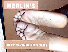 Merlin's Dirty Wrinkled Soles