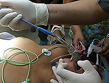 Endotracheal Intubation Woman