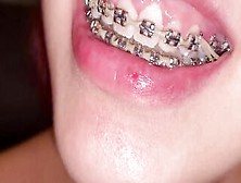 Sluts With Braces Shows Her Mouth Into Asmr