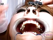 Playing Dentist