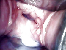 Speculum Observation During Continuous Vaginal Creampie