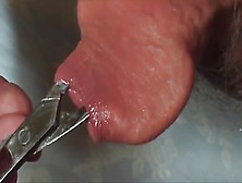 Foreskin - 4 Videos - Scissors Only