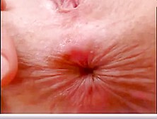 Teen Butthole Play Extreme Closeup