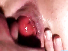 Prolapse Licking