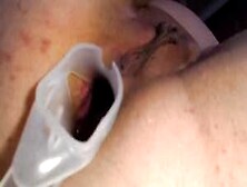 Anal Speculum And Orgasm Show From Asshole