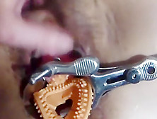 Wife And Speculum She Love It