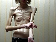 Anorexic Sonja 8T00359 29-05-2011