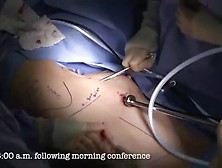 A Day In The Life Of A Thoracic Surgeon Timelapse