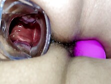 Anal Speculum With Very Intense Orgasms