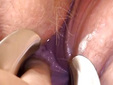 Speculum,  Pee Hole Play And Squirting