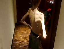 Anorexic Christin 8T00144 14-05-2018