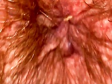 Close Up Hairy Ass Hole