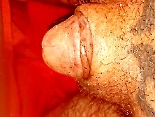 Burning Split Gland Head Into Urethra With Cigarette Tiny Cock And Balls