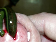 Leech Bite Head From Pee Hole